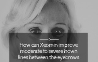 Xeomin improve moderate