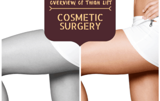 Lift Cosmetic Surgery