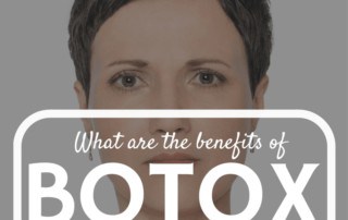 Benefits of Botox