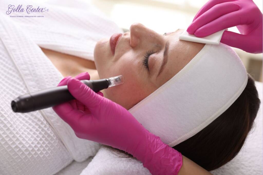 dihexa treatment pittsburgh Facial Rejuvenation Treatment Pittsburgh