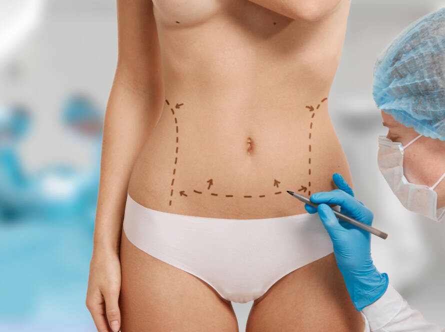 Tummy Tuck surgery treatment