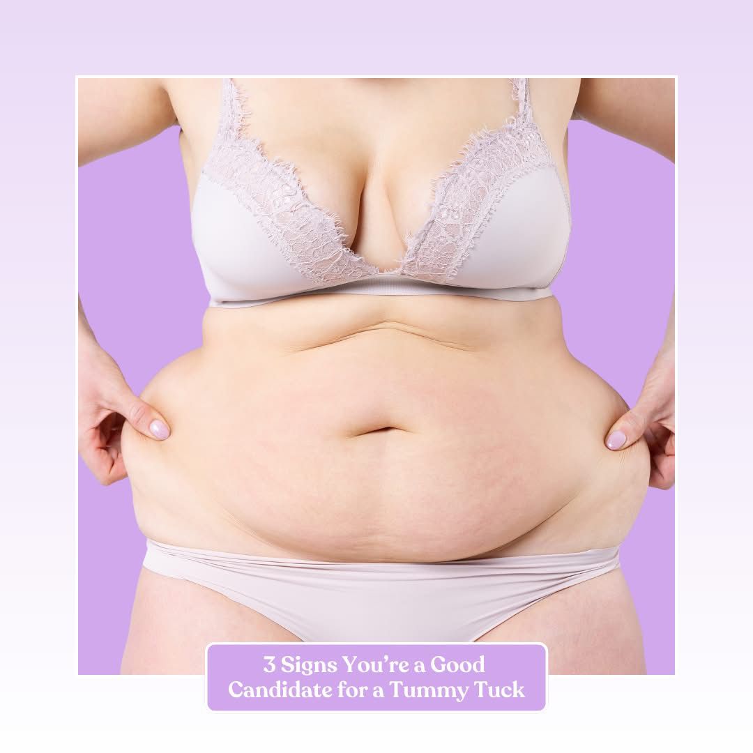 Tummy Tuck surgery at Pittsburgh Pa